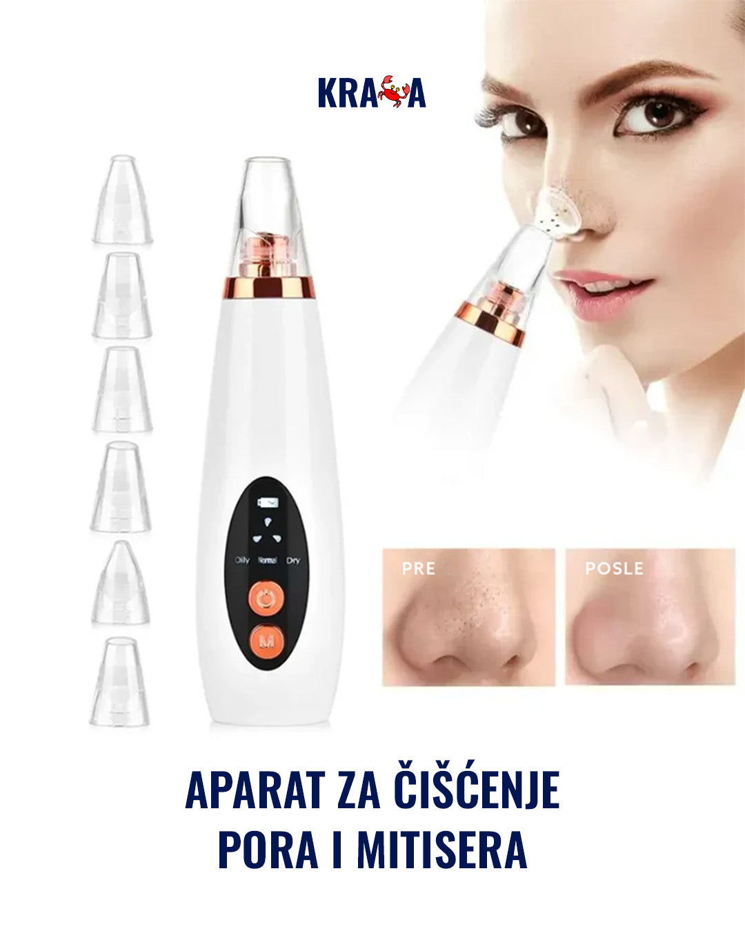 Aparat za čišćenje pora i mitisera, vakuum aparat za mitisere
