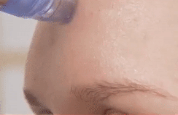 AquaVac Skin – Nežna, ali efikasna nega lica