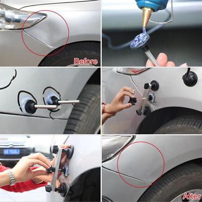 Pops-a-dent - Set za ispravljanje udubljenja na automobilu - Topopusti