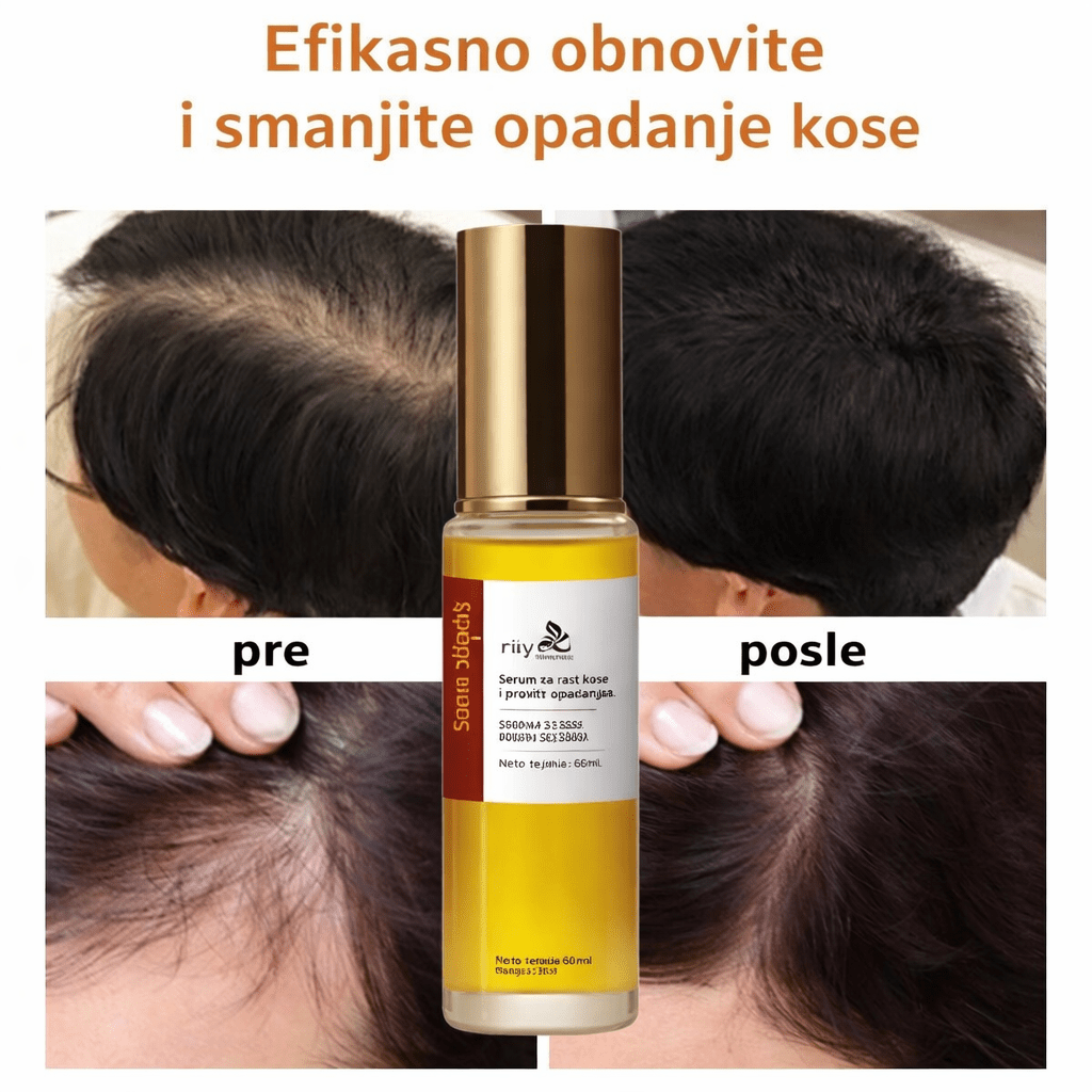 Ulje za intezivnu negu i reparaciju kose (50 ml) - Topopusti